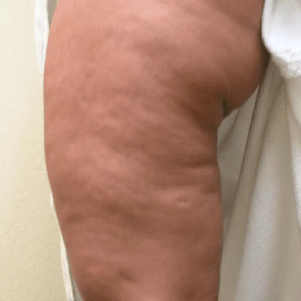 Barbara, 42, day 1