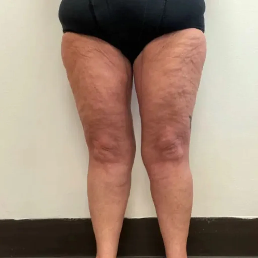 Amanda, 48, Day 28