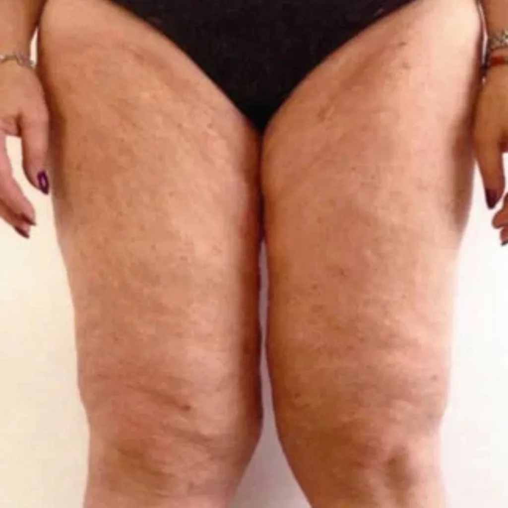 Shauna, 55, Day 72