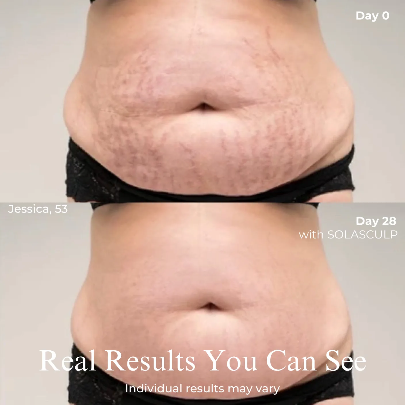 Stomach before and after, day 0 and day 28